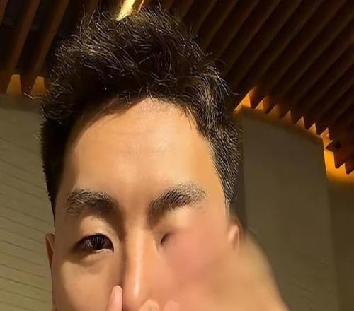 李添榮回懟網友評論：冠軍是我們拼回來的真搞笑你有冠軍嗎